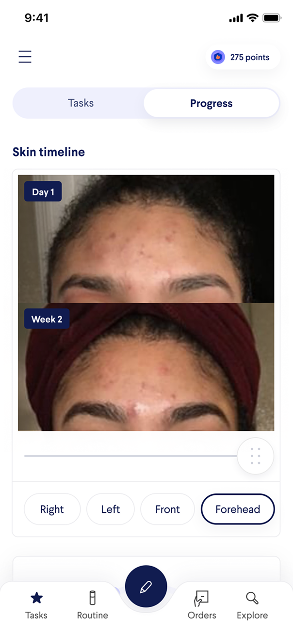 Curology app screen: skin timeline